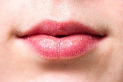 wrinkles-above-the-lips-the-best-treatments-prevention